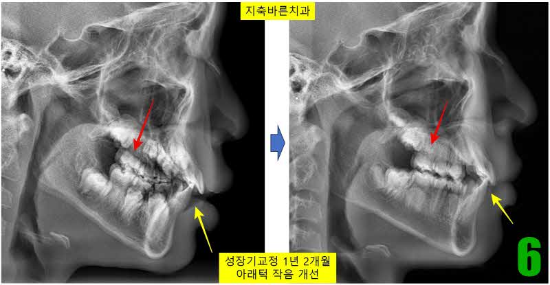 6. 1년 2개월 ceph_s.jpg