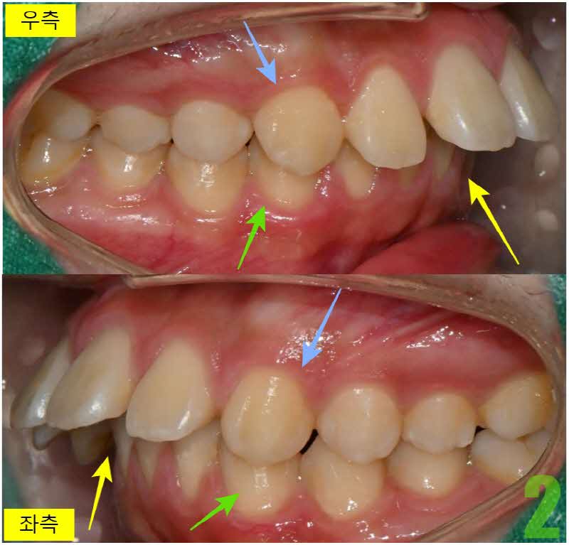 2. 초진 좌우_s.jpg