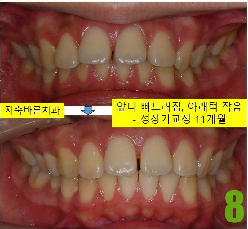 8. 11개월 정면_s.jpg