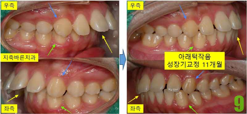 9. 11개월 좌우_s.jpg
