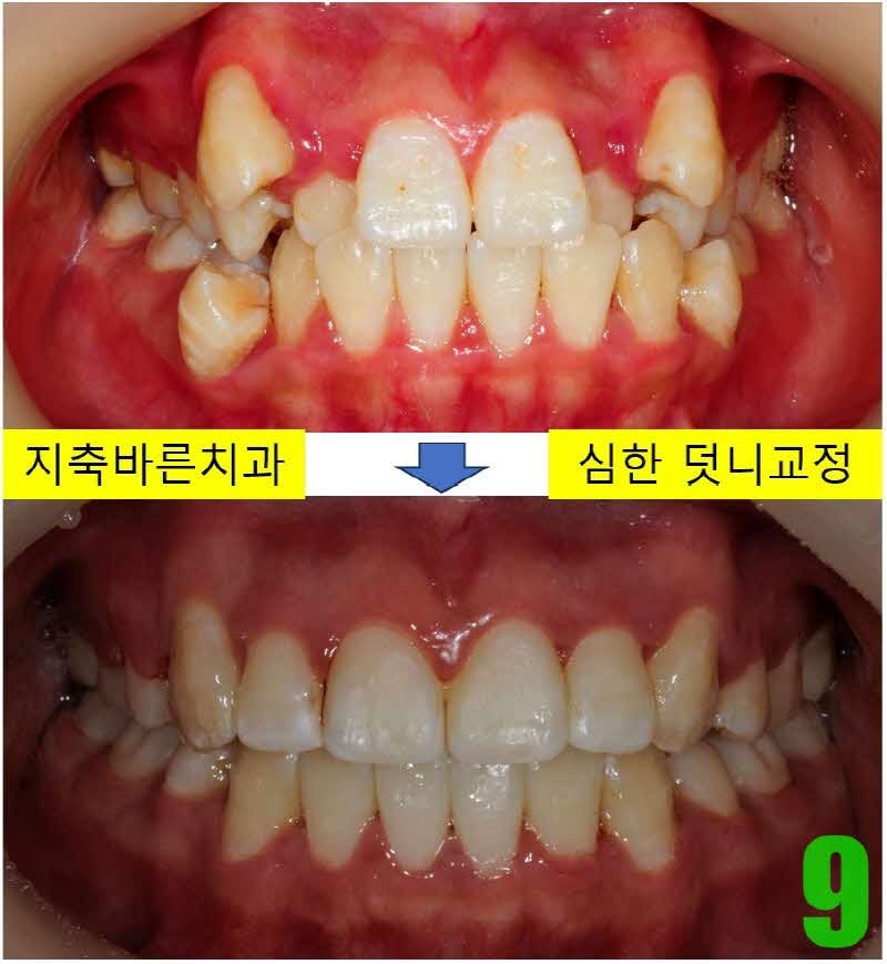 9. 디본딩 정면_s.JPG