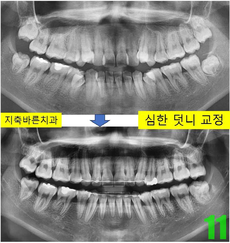 11. 디본딩 pan_s.jpg