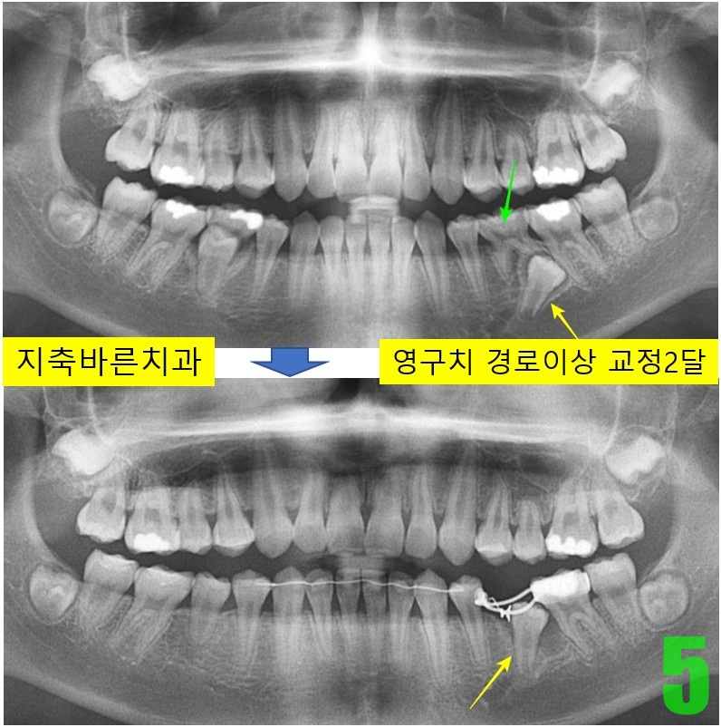 5. #35 경로개선 2달.jpg