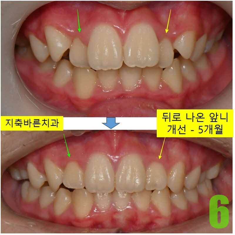 6. 5개월 정면_s.jpg