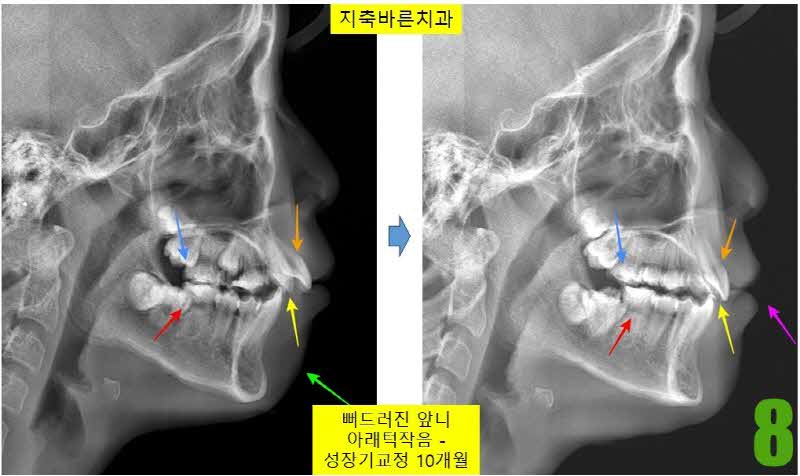 8. 8개월 셉_s.jpg