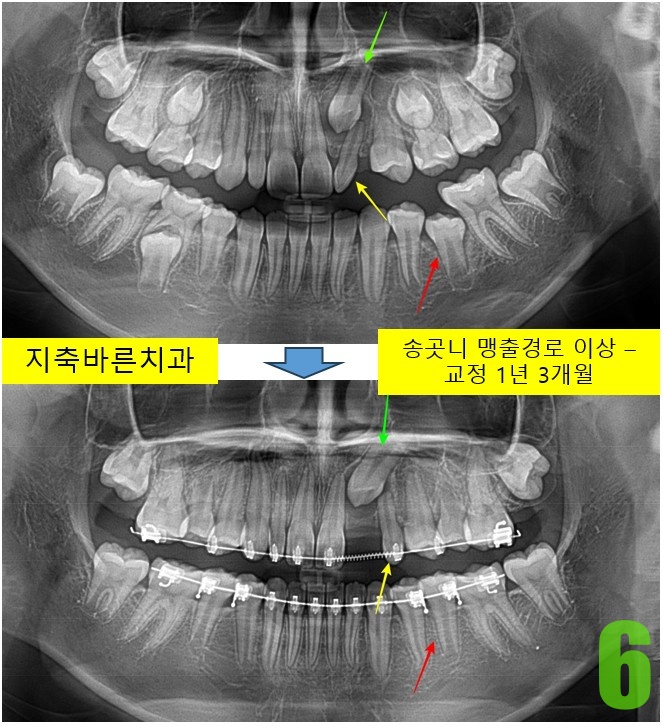6. 교정 1년 3개월.jpg